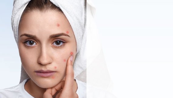 Dr.Ram's Skin Remediez offers